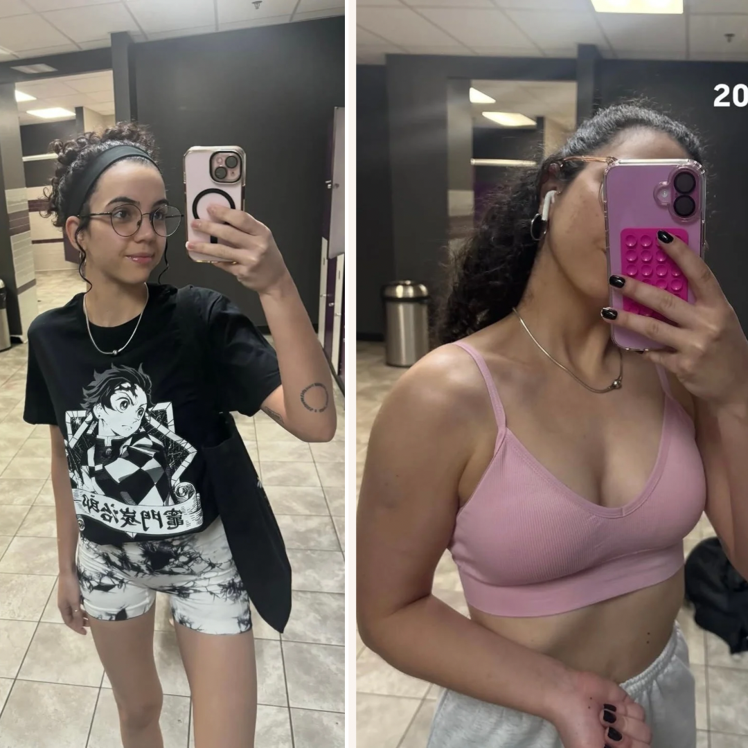 Before after minimal skincare Instagram post