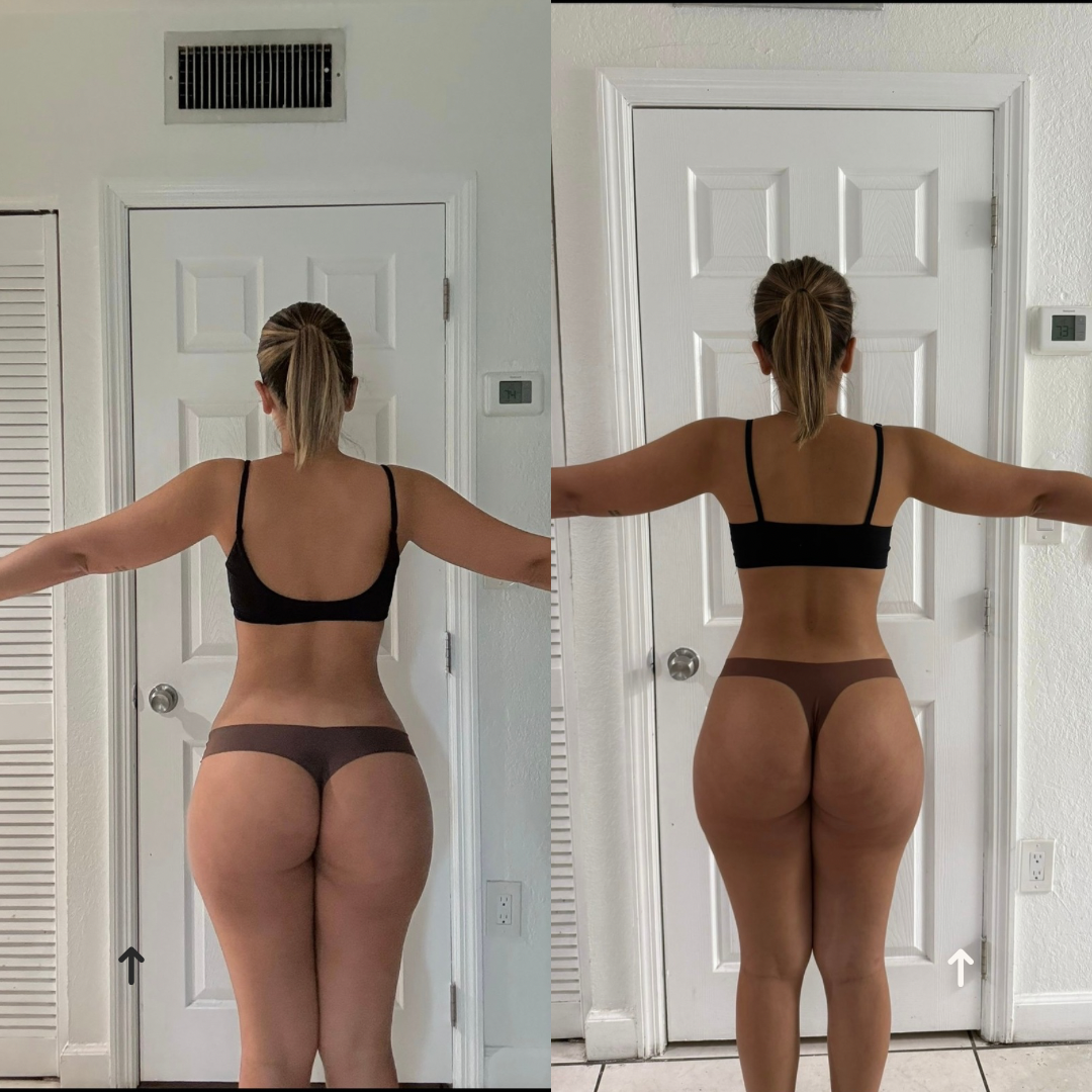 Beige Minimalist Skincare Before and After Instagram Post